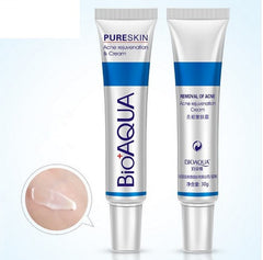 Anti Acne Removal Gel Whitening