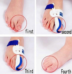 Bone Ectropion Toes Outer Appliance